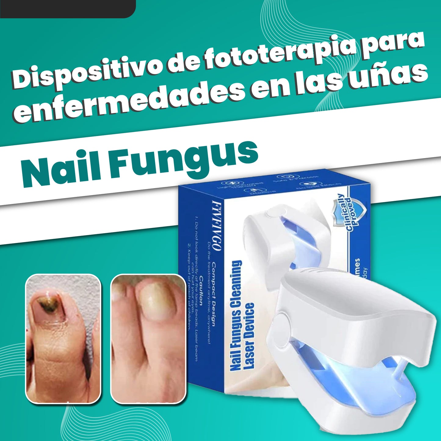 Dispositivo de fototerapia para enfermedades en las uñas - Nail Fungus™