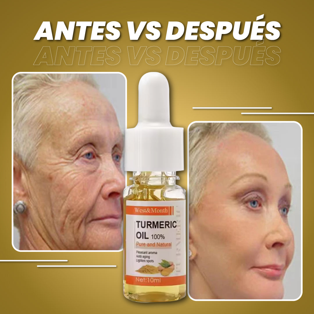 Botox facial para arrugas - Bot Solution™