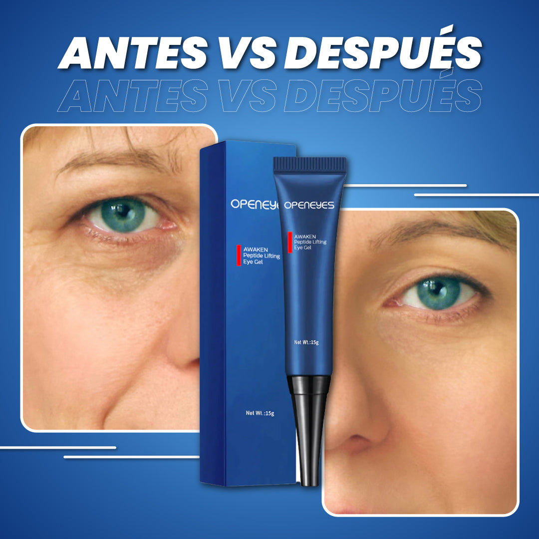 1+1 GRATIS | Crema anti ojeras y bolsas oscuras - Eyes Quit™