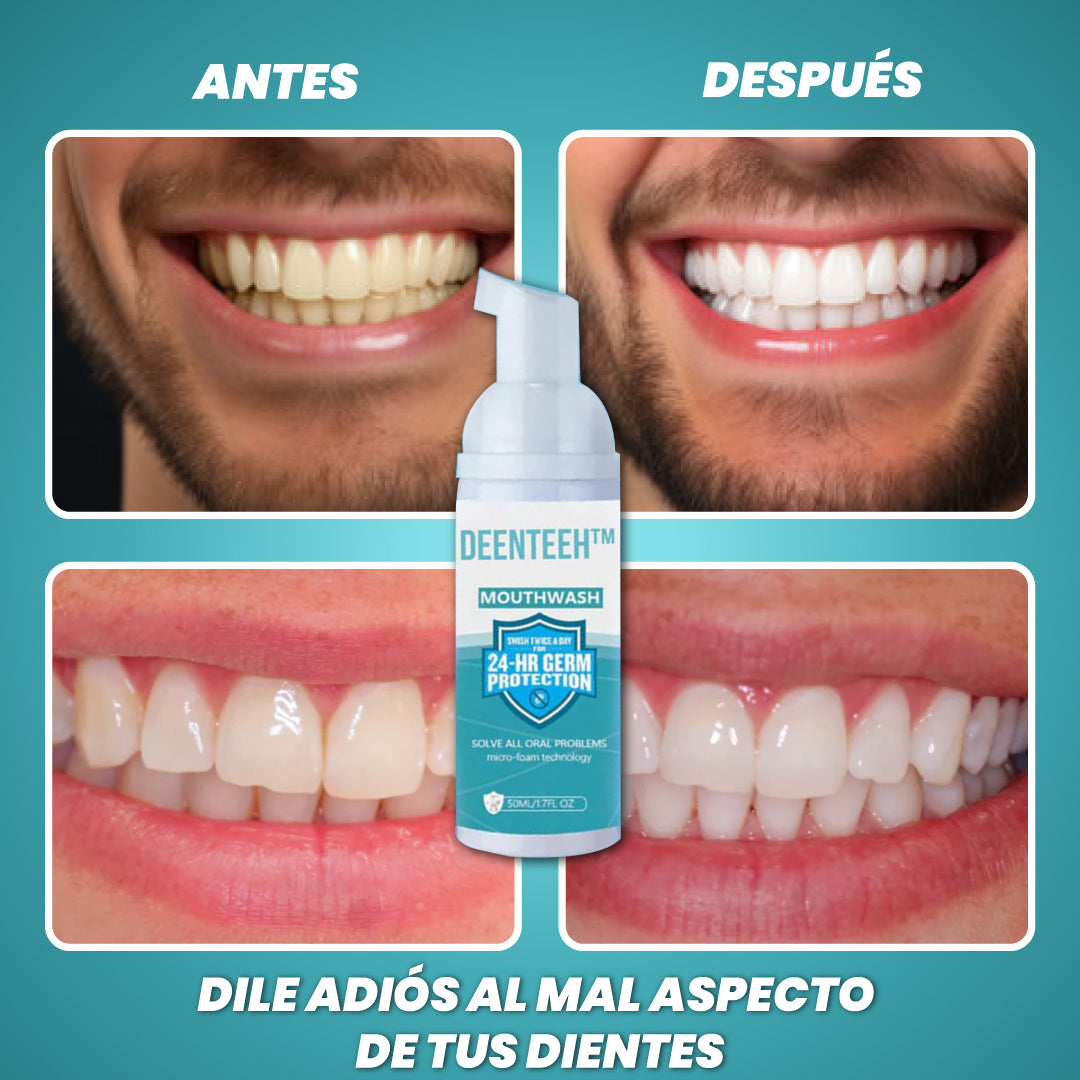 1+1 GRATIS | Pasta de dientes blanqueadora y antibacterias - Denteeth™