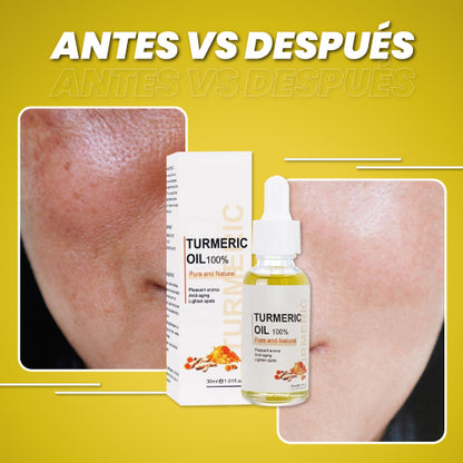 Suero rejuvenecedor anti-manchas - Turmeric Face™